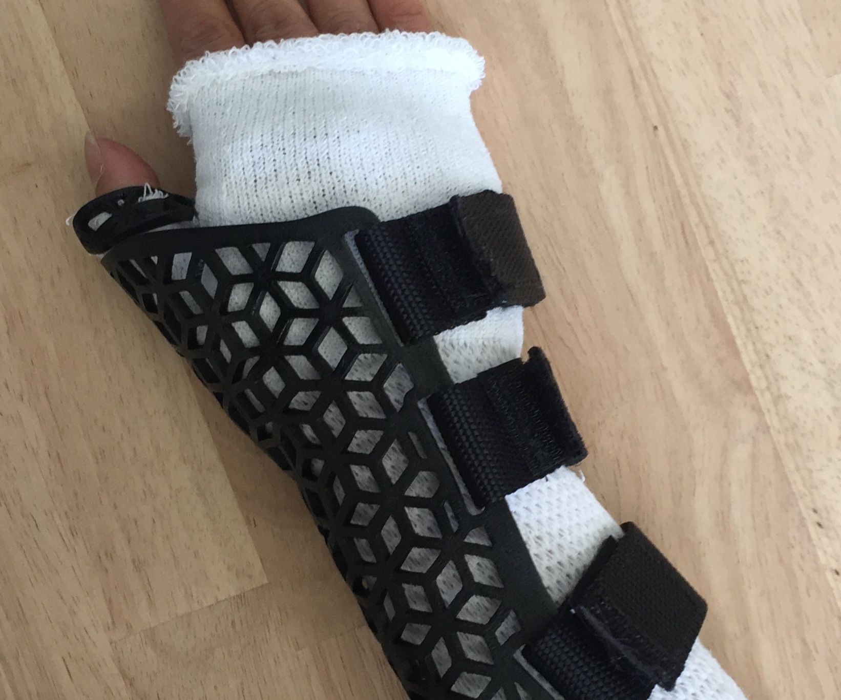 3D Printed - Thumb + Wrist Immobilization Brace : 5 Steps (with