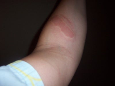 Freeze Branding Yourself - Exploration Into Self Modification. : 5