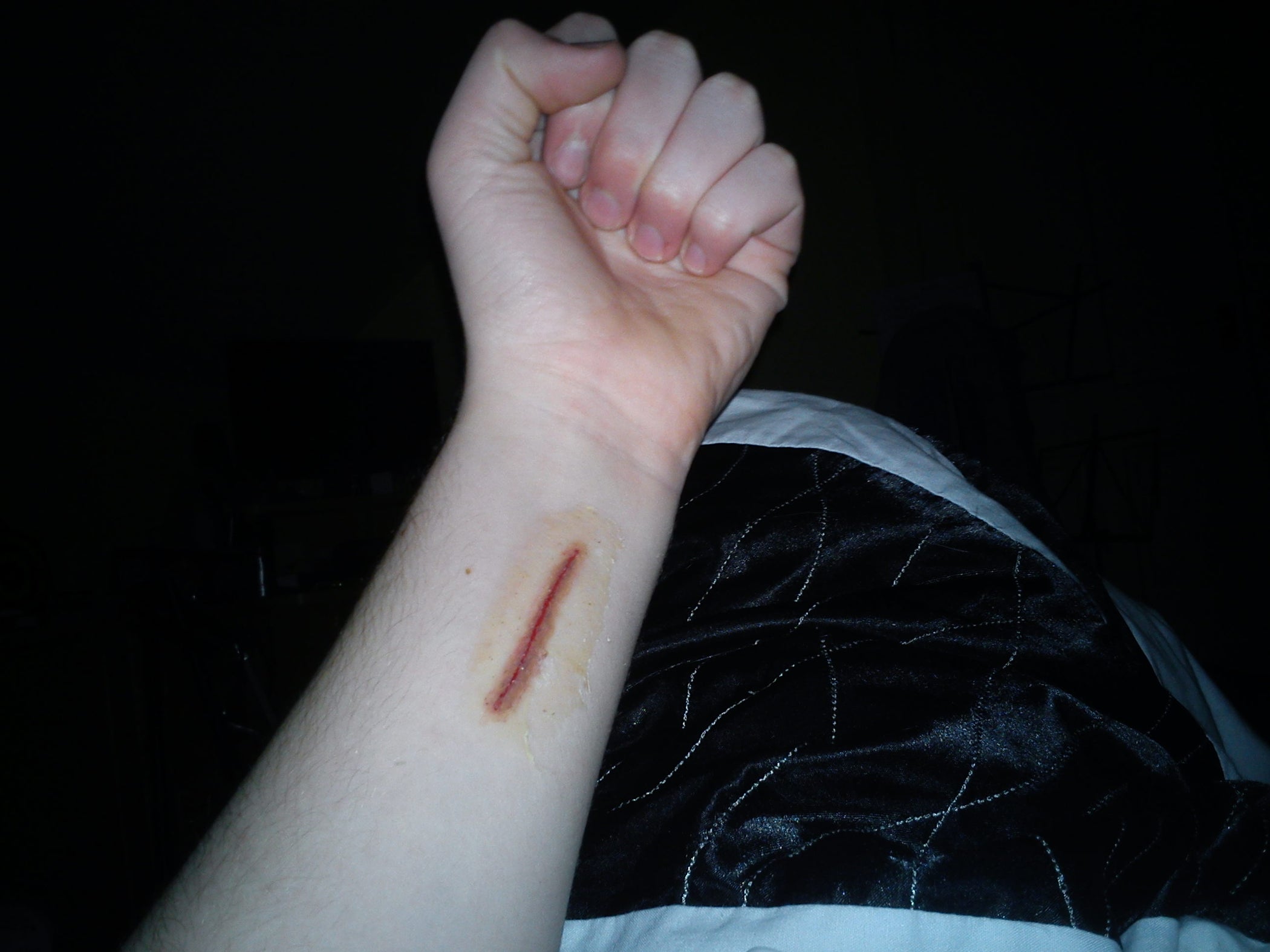 How to Make Latex Scars 8 Steps Instructables