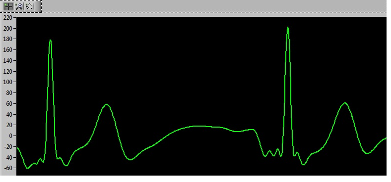 Arduino Based ECG & Heartbeat Monitoring Healthcare System | Trybotics