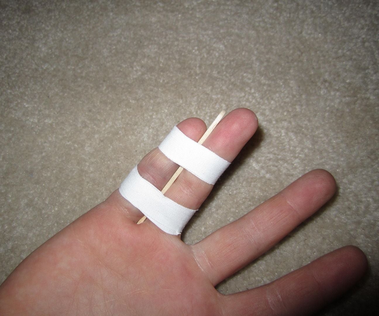 Easy Finger Brace 4 Steps Instructables